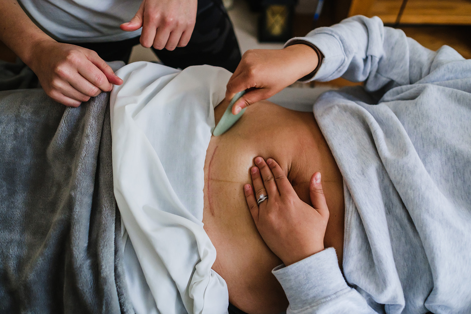 C-section Scar Massage Class - Hannah Johnson Therapies